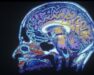 Färglagd sagittal hjärnbild som visar hjärnans inre strukturer